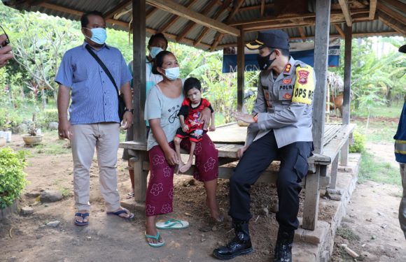 Kapolres Buleleng Beri  Bantuan Sosial Kepada Seorang Anak Yang Lumpuh.
